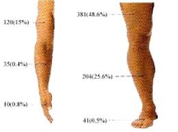 Extremity(limb)Sarcoma