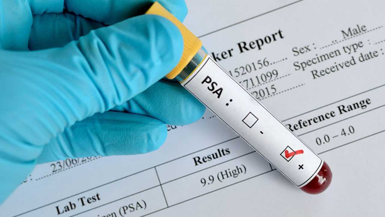 Best Cancer Care clinic in Pune