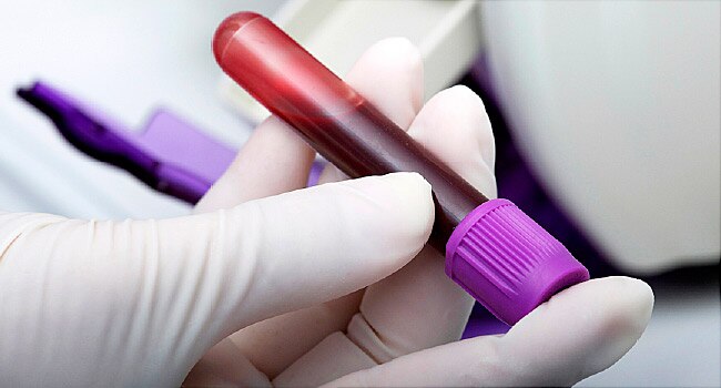650x350_cancer_prevention_screening_ref_guide