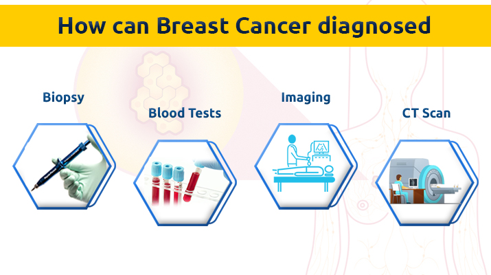 How can it be diagnosed Breast cancer surgeon in Pune