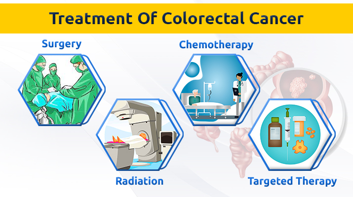 Prolife Cancer Centre Colorectal Cancer Treatment In Pune