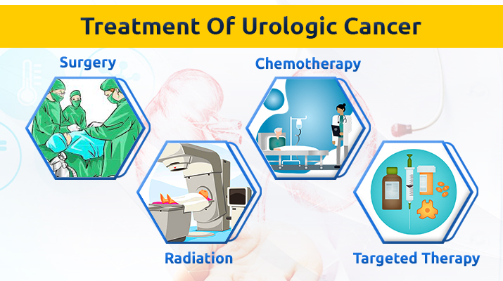 Treatment Of Pharynx Cancer