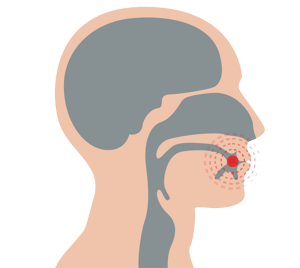 oral cancer treatment in kolhapur
