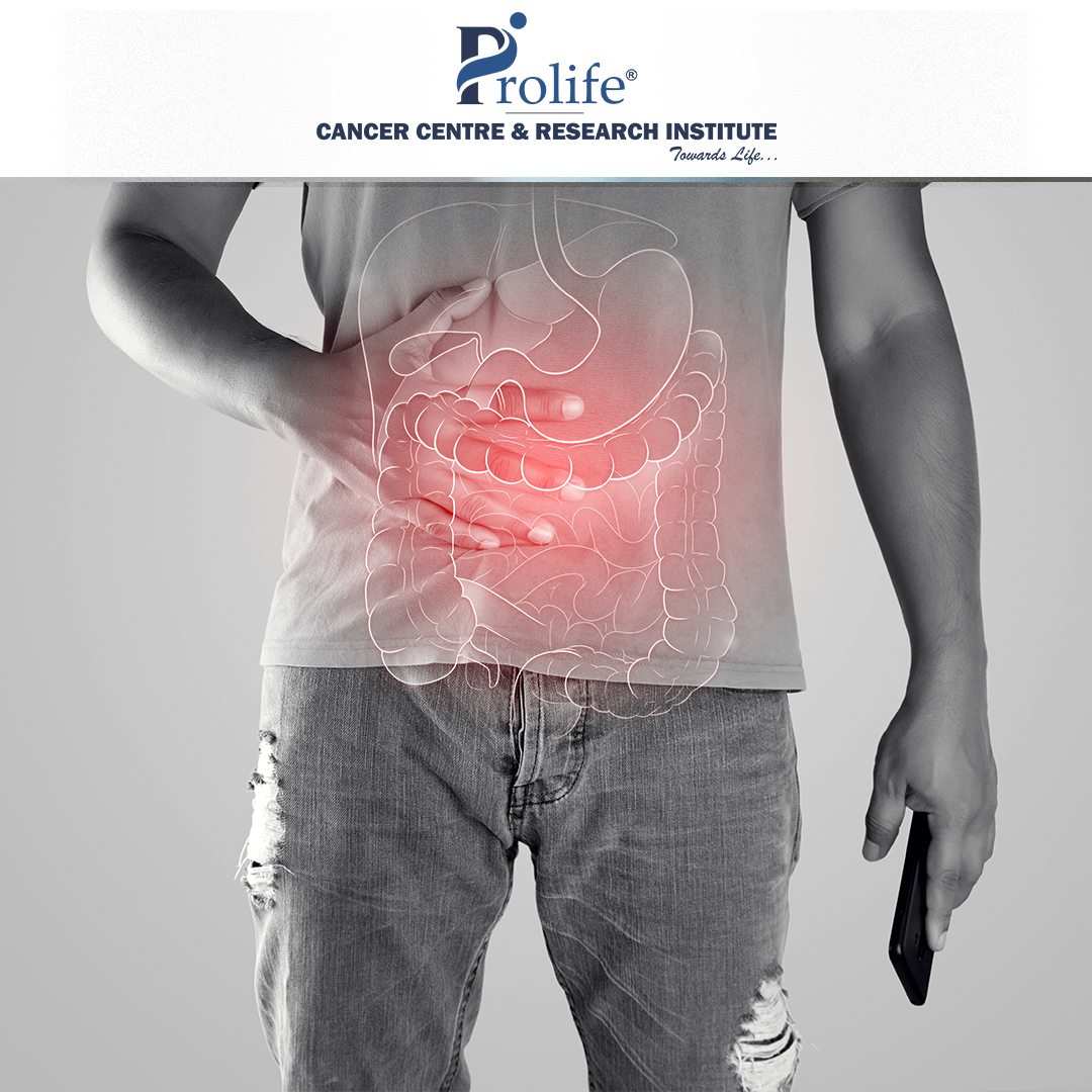 Colorectal Cancer Treatment in Pune