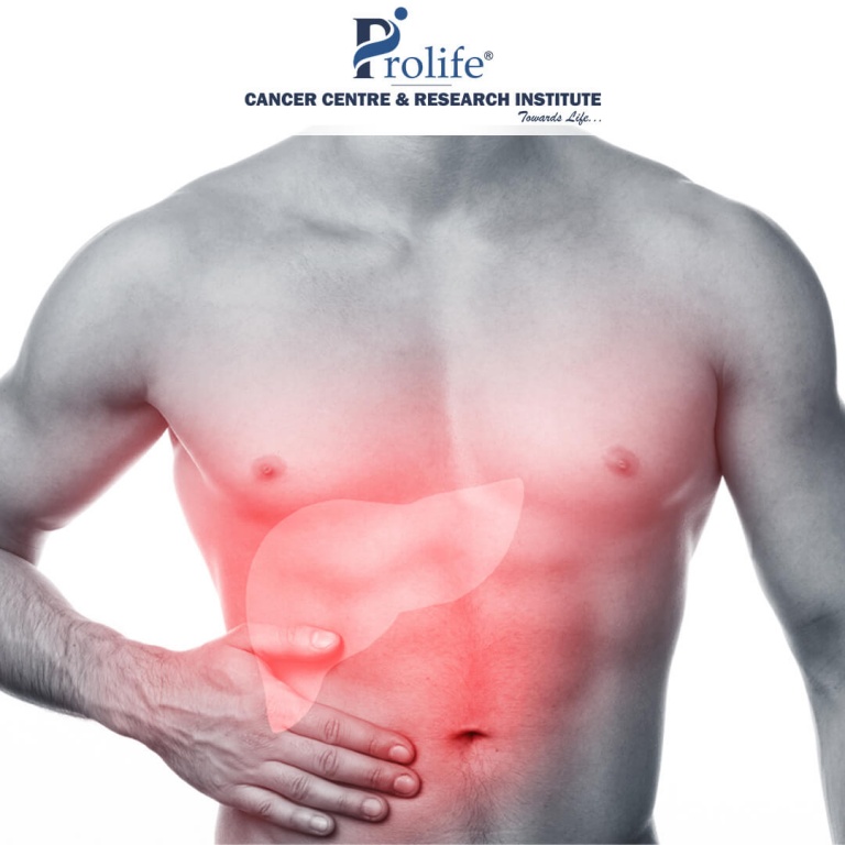 Gallbladder Cancer Get Facts on Stages and Treatment Prolife Cancer Centre