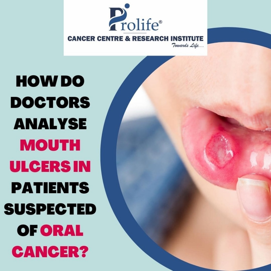 Mouth cancer treatment in Pune