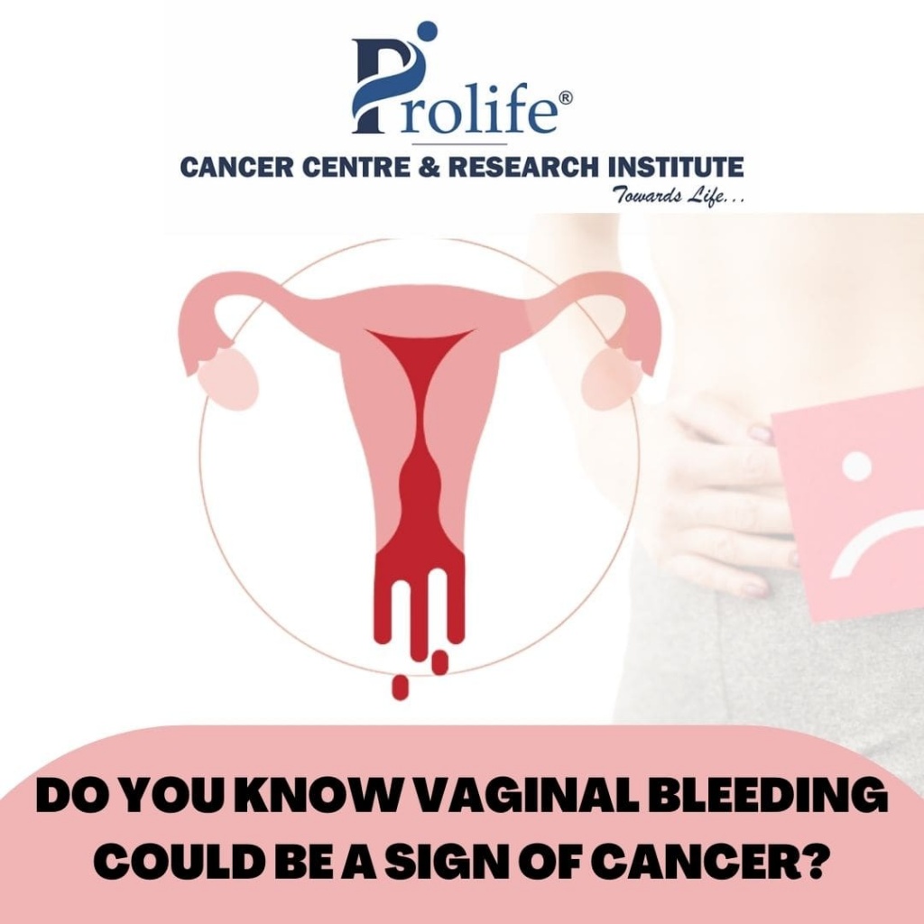 Vaginal Cancer Treatment in Pune