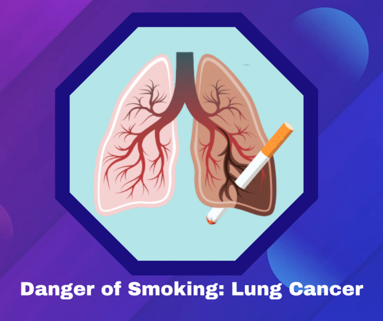 The danger of Smoking Lung Cancer Prolife Cancer Centre