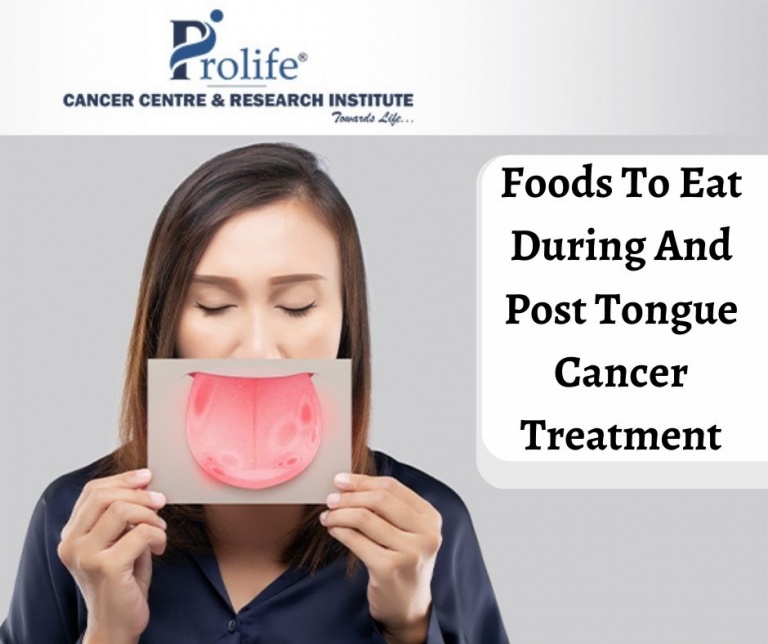 Foods To Eat During & Post Tongue Cancer Treatment