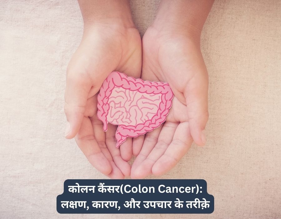 कोलन कैंसर(Colon Cancer): लक्षण, कारण, और उपचार के तरीक़े | Prolife Cancer Centre | Dr. Sumit Shah