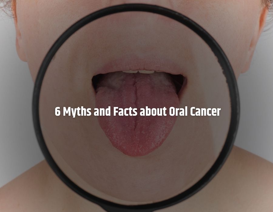 6 Myths and Facts about Oral Cancer | Oral Cancer Surgeon in pune | Oral Cancer Specialist In Pune | Dr. Sumit Shah